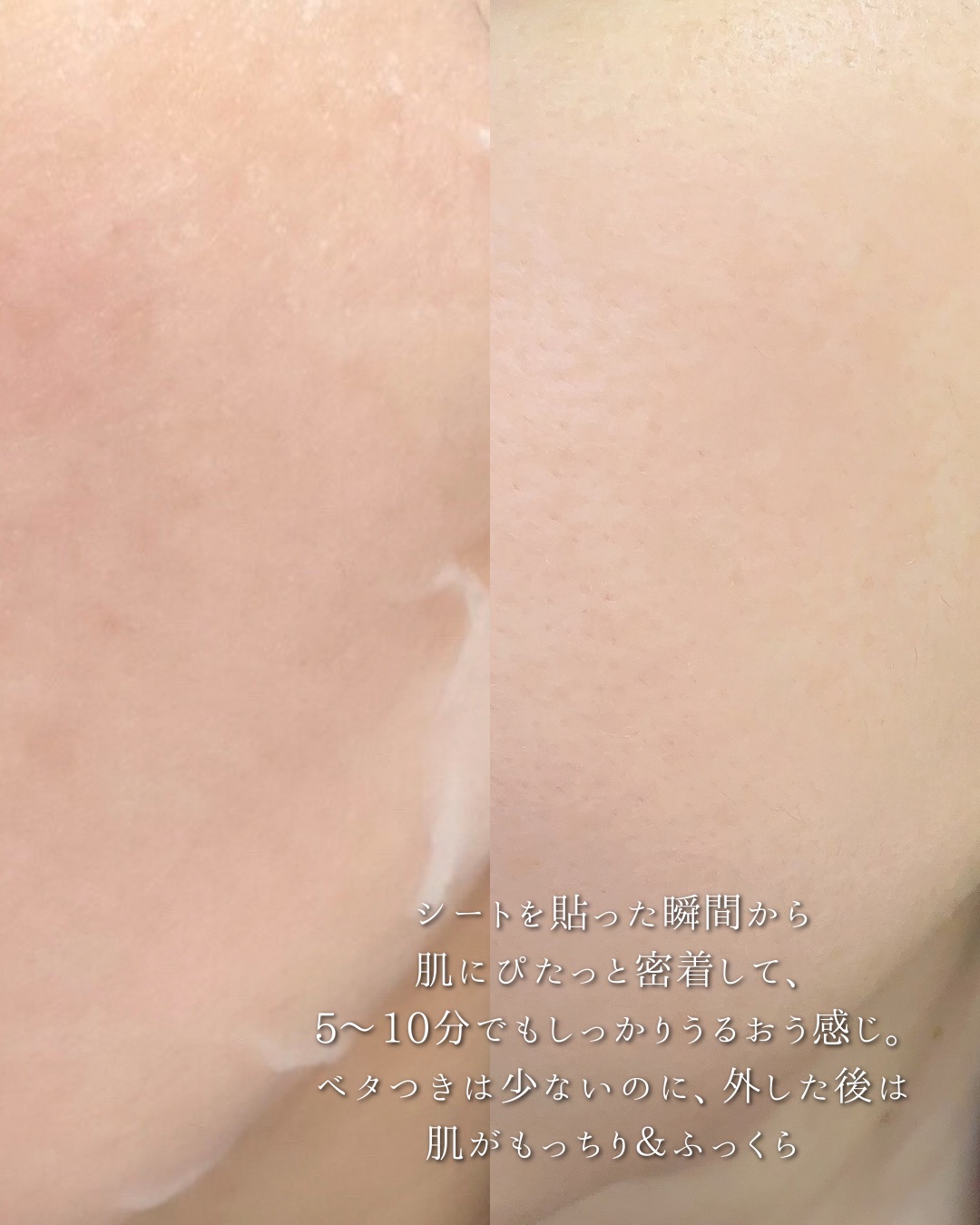 マデカッソシドブレミッシュパッド/MEDIHEAL/トナーパッドを使ったクチコミ（3枚目）