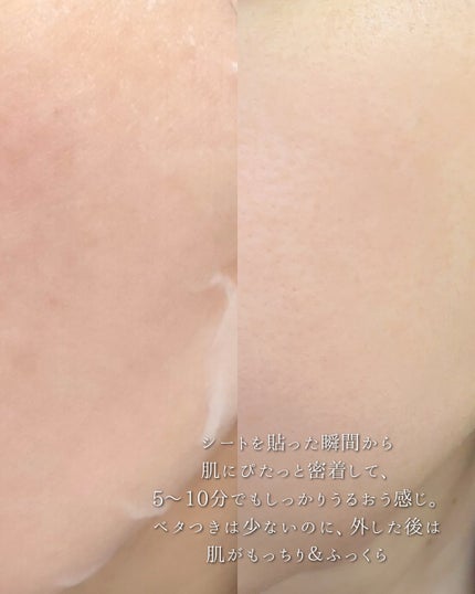 ããã«ããœã·ããã¬ããã·ã¥ããã/MEDIHEAL/ãããŒãããã䜿ã£ãã¯ãã³ãïŒ3æç®ïŒ