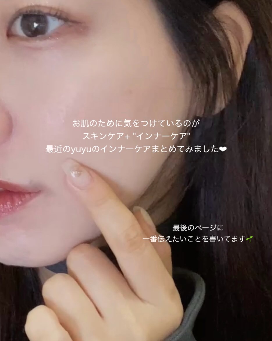 ビタミンC「2000」（医薬品）/武田薬品工業/健康サプリメントを使ったクチコミ（2枚目）