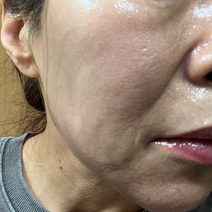 ローメルト クレンジングバーム クロ/アーレス/クレンジングバームを使ったクチコミ(5枚目)