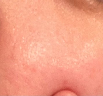 シカレチA マスク/VT/シートマスク・パックを使ったクチコミ(2枚目)