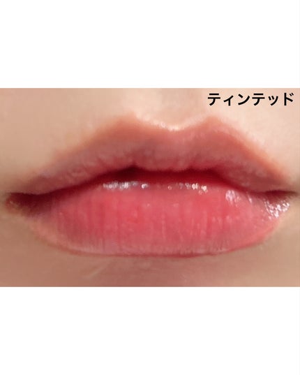 レチナールリップバーム/Dr.Different/リップバームを使ったクチコミ(6枚目)