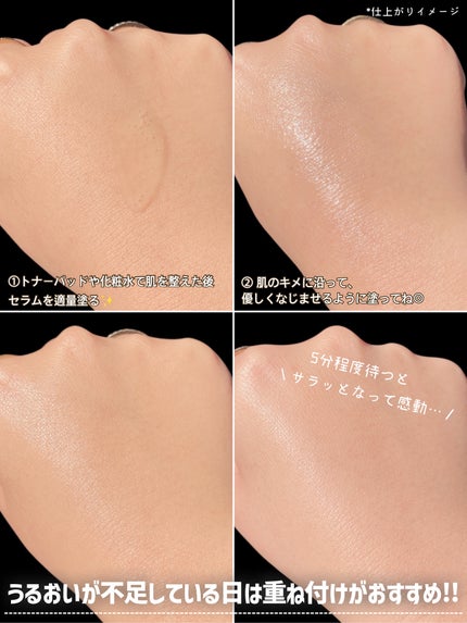 トラブルターゲティングセラム/EIOM/美容液を使ったクチコミ(9枚目)