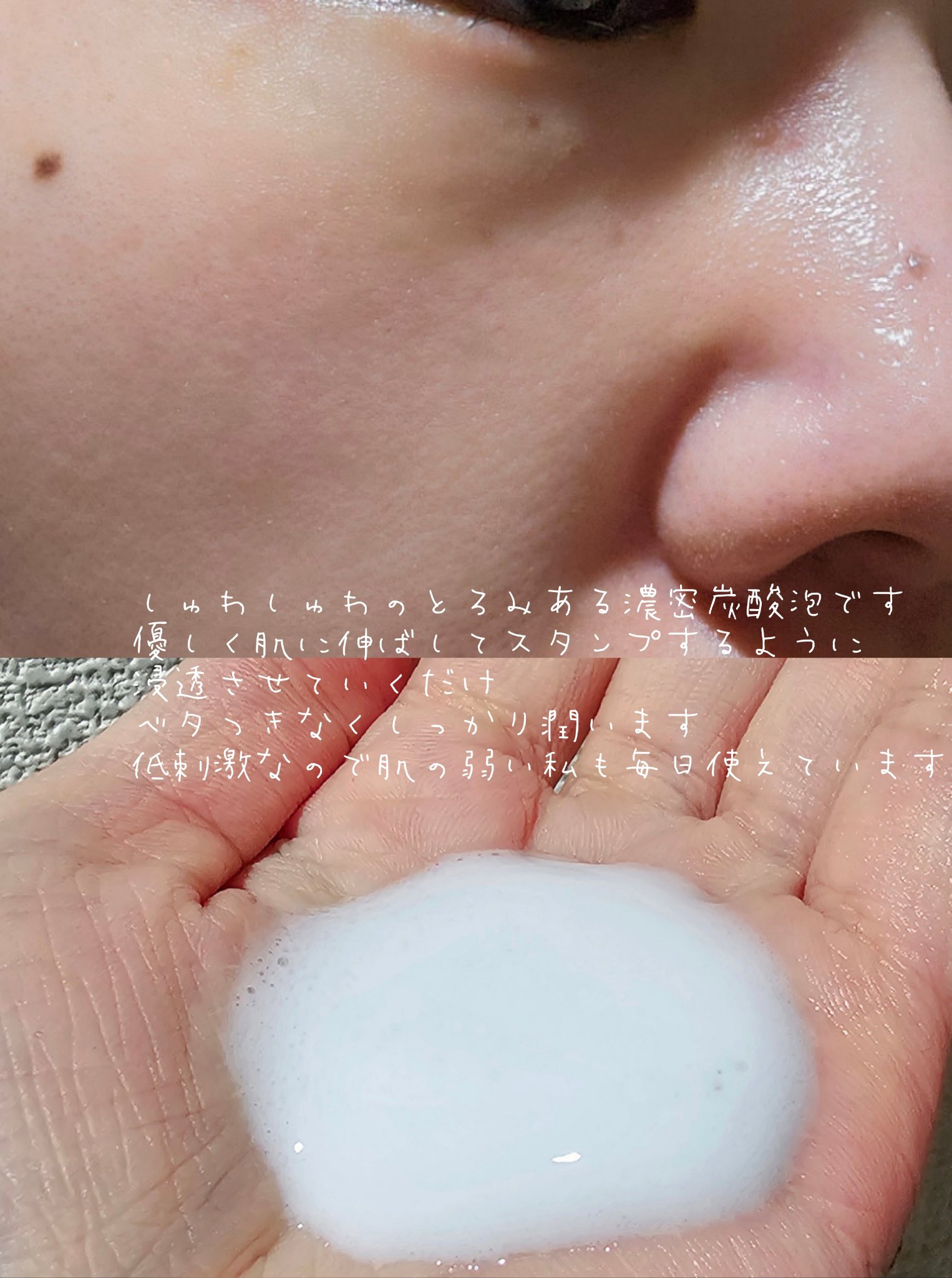 アネラホワイト/ANELA WHITE/美容液を使ったクチコミ（3枚目）