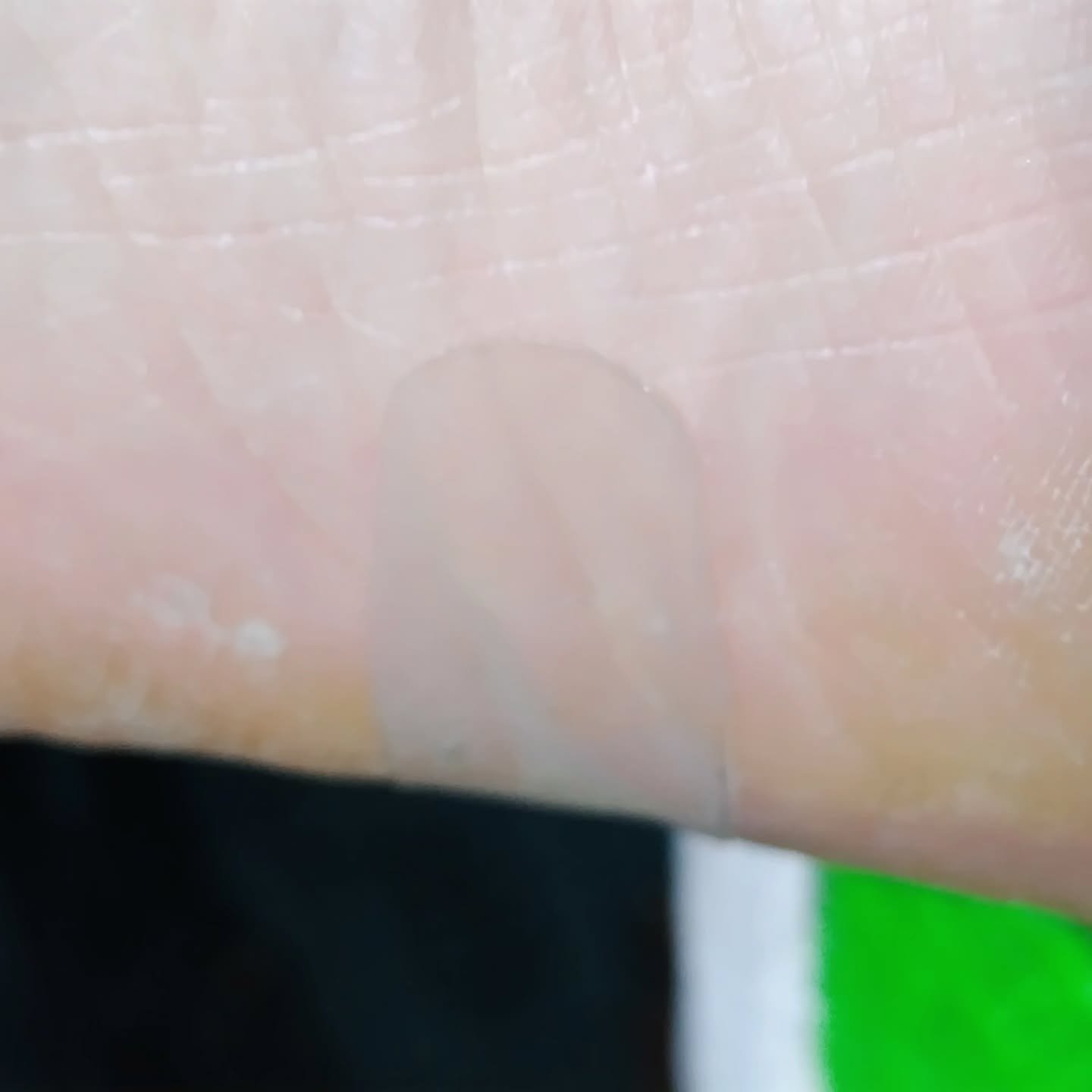 キズクイック/東洋化学/その他を使ったクチコミ（2枚目）