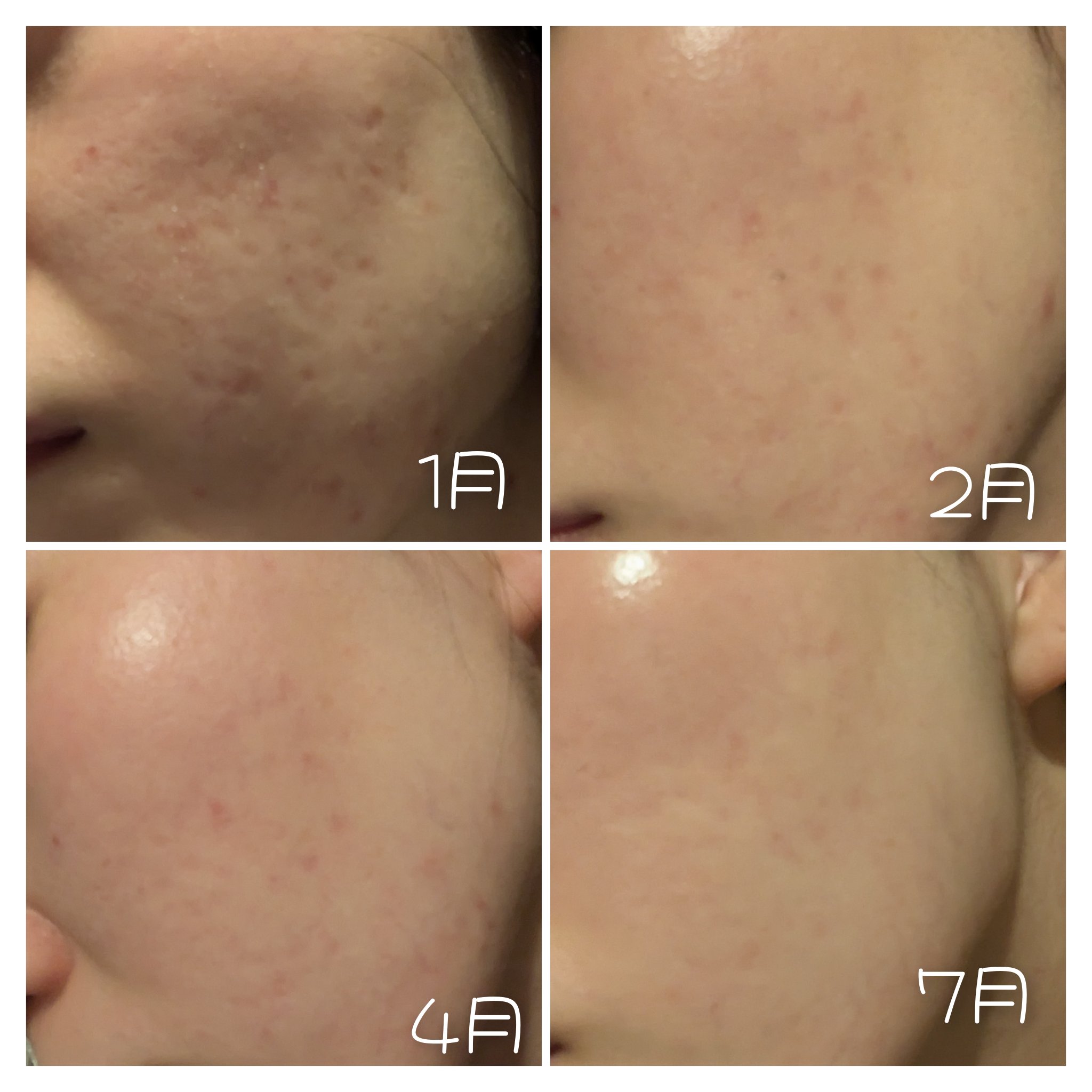 コールドクリーム/ウテナモイスチャー/クレンジングクリームを使ったクチコミ（2枚目）