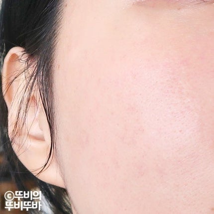 ユキのビューティー勉強部屋 on LIPS 「【アヌアPDRNヒアルロン酸100セラムを徹底レビュー🇰🇷✨】..」(7枚目)