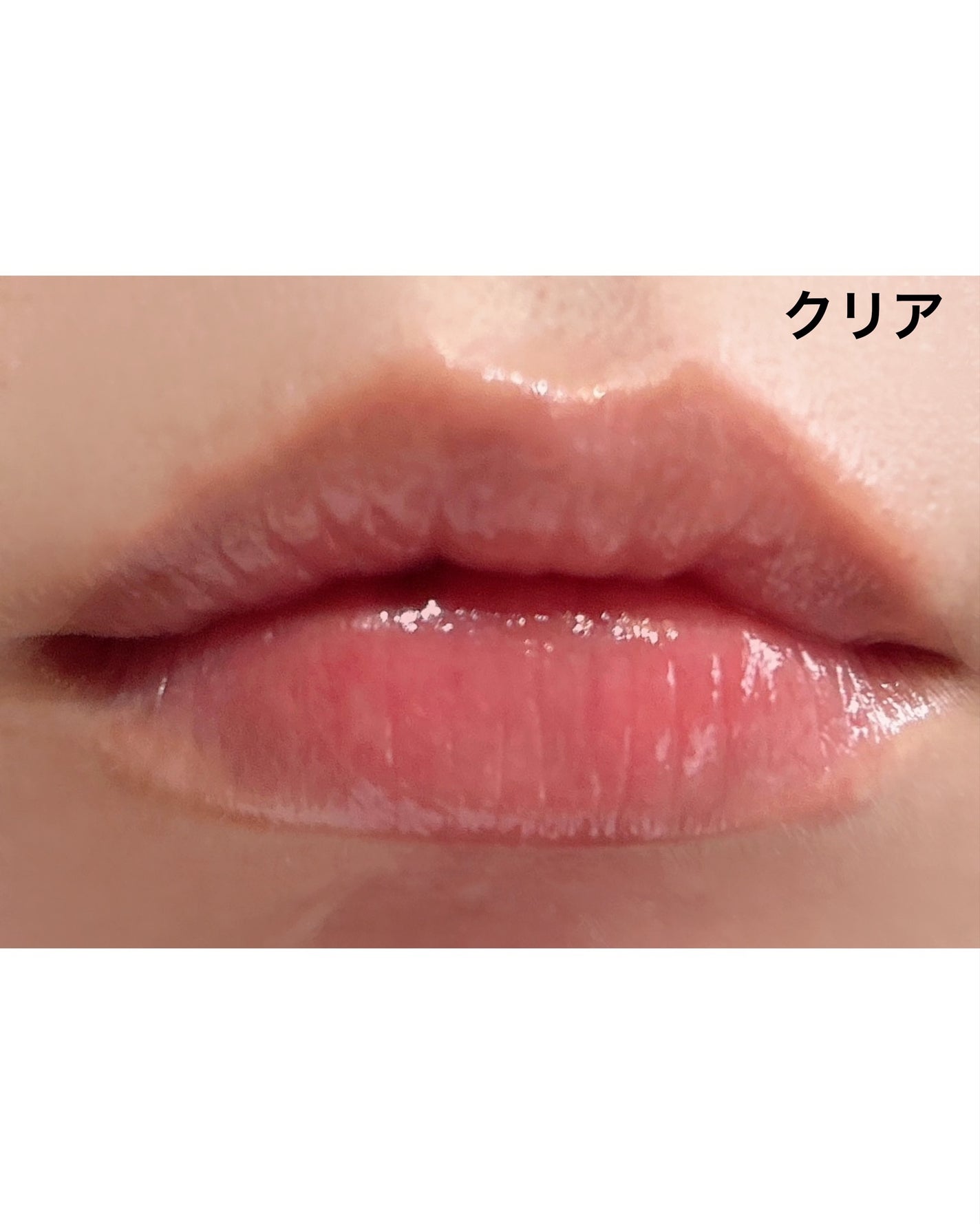 レチナールリップバーム/Dr.Different/リップバームを使ったクチコミ(5枚目)