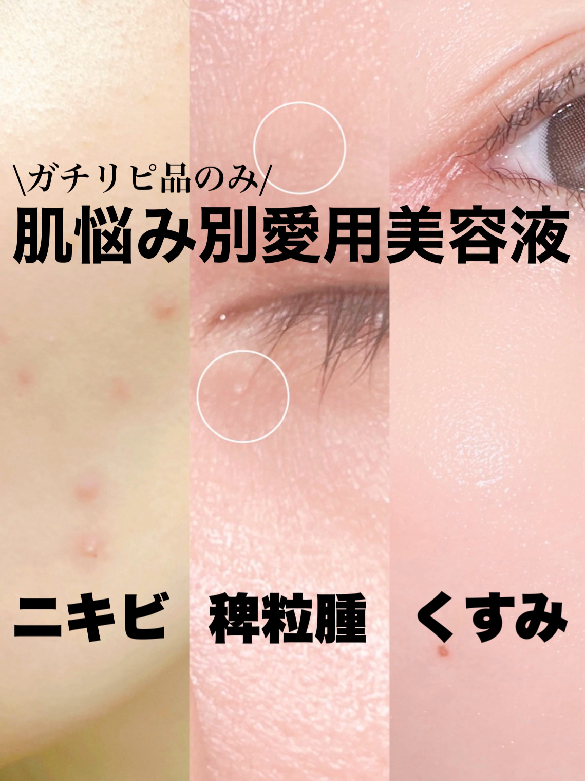 オーガニック ハトムギエキス (ヨクイニン)/KISO/その他を使ったクチコミ（1枚目）