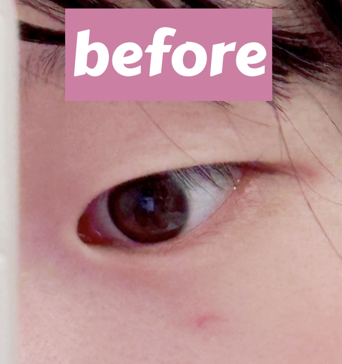 オリシキ アイリッドスキンフィルム EX/D-UP/二重まぶた用アイテムを使ったクチコミ（2枚目）