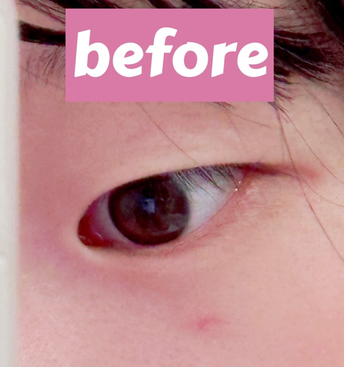 オリシキ アイリッドスキンフィルム EX/D-UP/二重まぶた用アイテムを使ったクチコミ(2枚目)