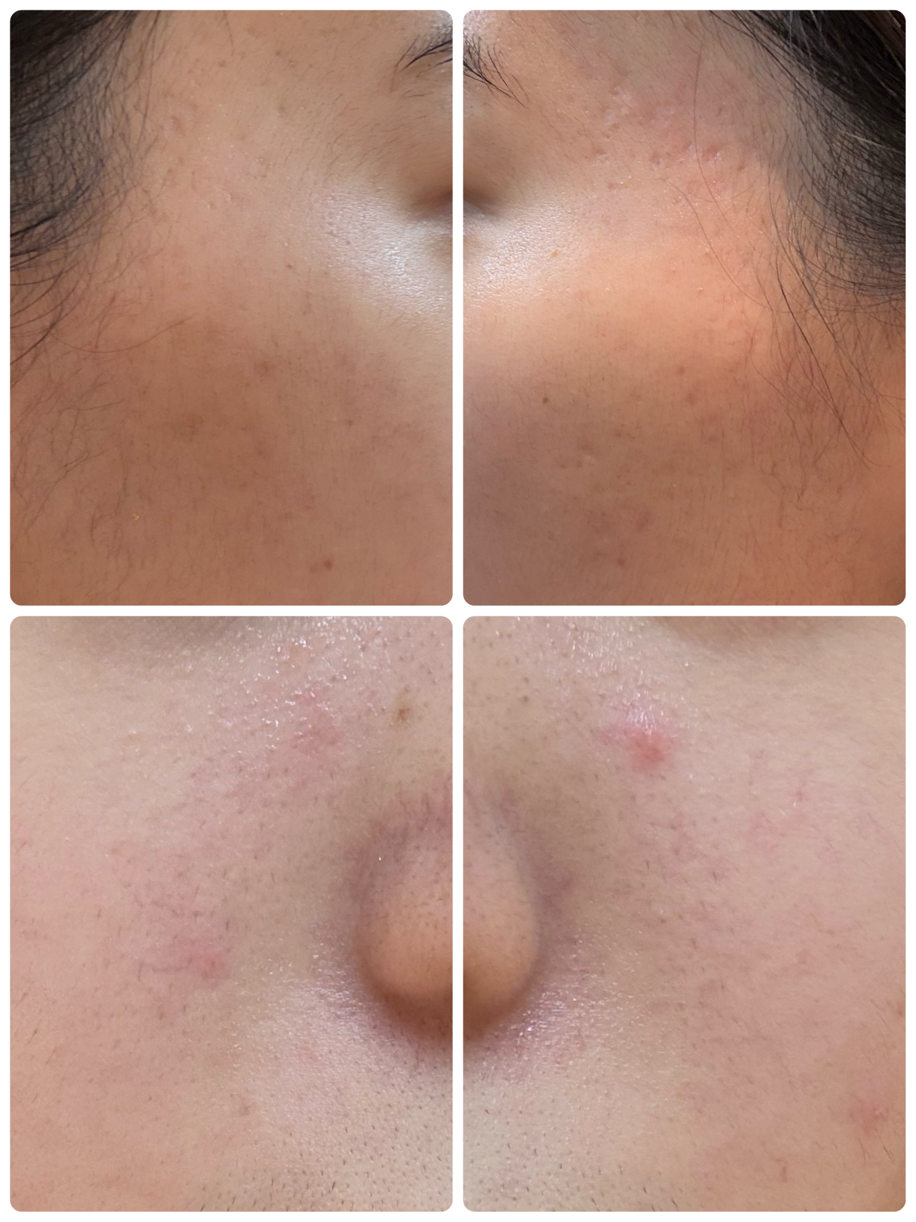 ディズム EMS EER メディスキンケアデバイス/DISM/美顔器・マッサージを使ったクチコミ（2枚目）