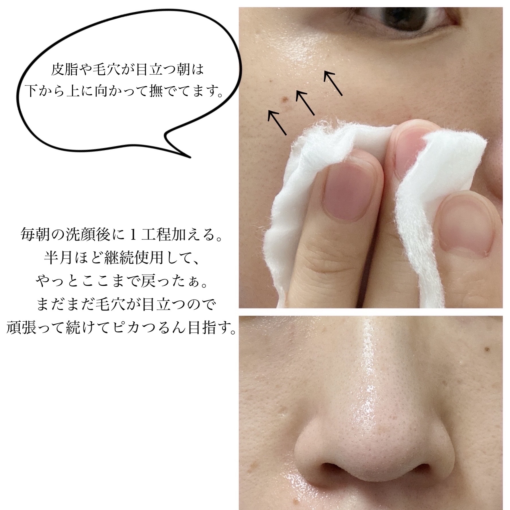 ネイチャーコンク 薬用クリアローション/ネイチャーコンク/拭き取り化粧水を使ったクチコミ（3枚目）