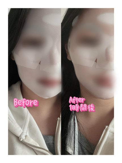 パーフェクト リアル パフォーマンス コラーゲンマスクパック /ダーマフィックス/シートマスク・パックを使ったクチコミ(2枚目)