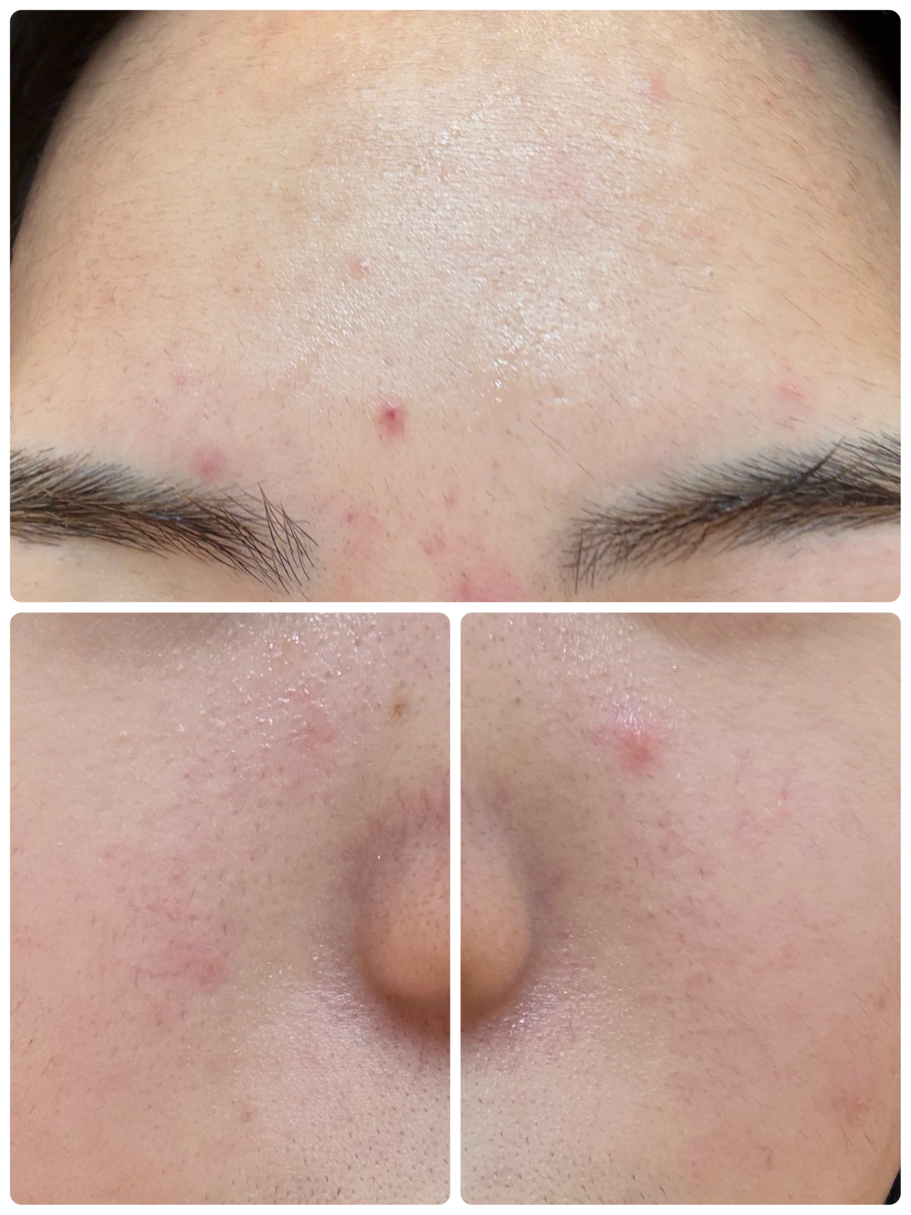 ディズム EMS EER メディスキンケアデバイス/DISM/美顔器・マッサージを使ったクチコミ（3枚目）