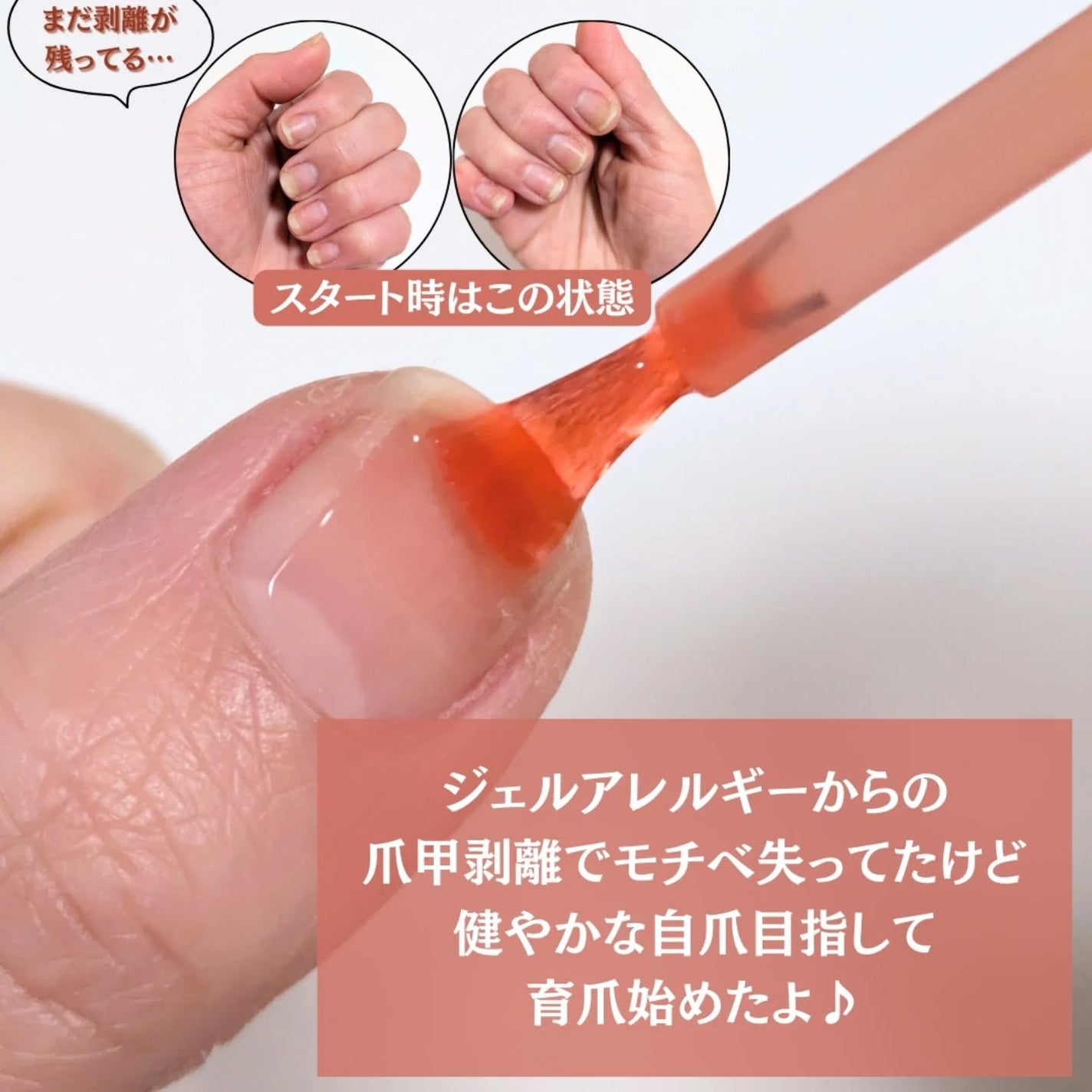 001 ヴィーガンティンテッドネイルハードナー/FOIND/ネイル用品を使ったクチコミ(3枚目)