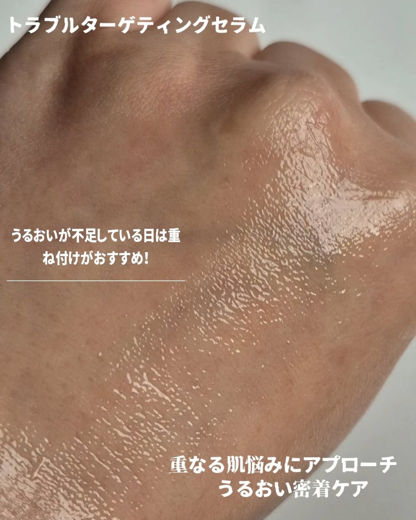 トラブルパッチマスク/EIOM/その他スキンケアを使ったクチコミ(3枚目)