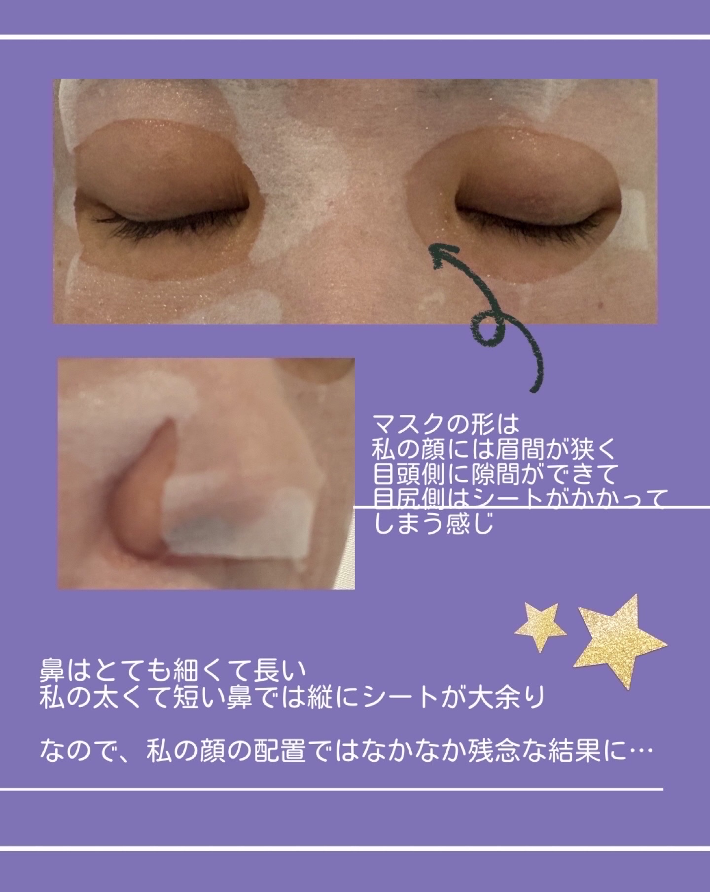 VCチャージ  ホワイトマスク/PERFECT ONE  FOCUS/シートマスク・パックを使ったクチコミ（3枚目）