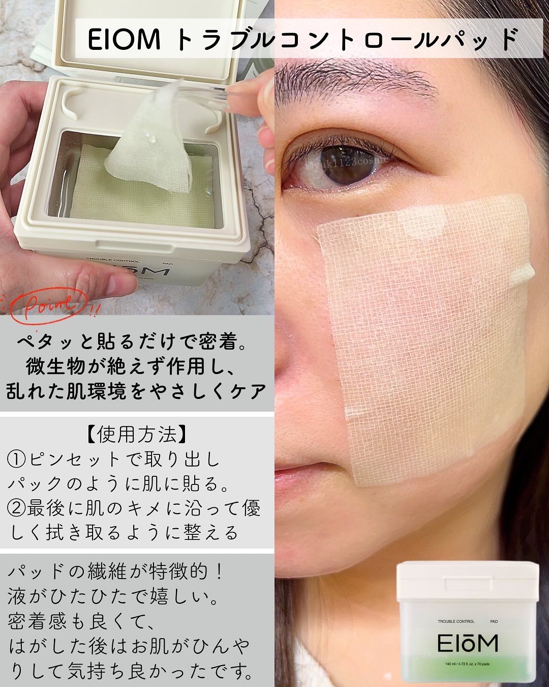 トラブルパッチマスク/EIOM/その他スキンケアを使ったクチコミ（3枚目）