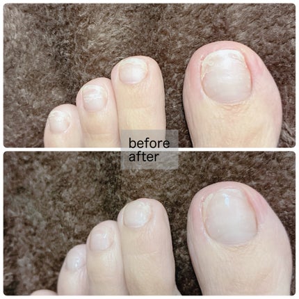 ベビーフット 足爪プロティンパック/ベビーフット/レッグ・フットケアを使ったクチコミ(3枚目)