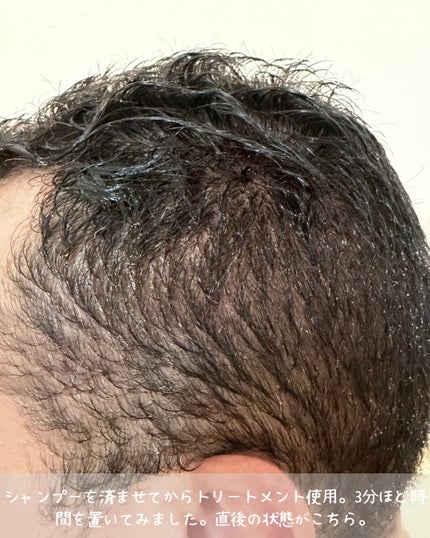 エッセンスカラートリートメント/LPLP(ルプルプ)/ヘアカラーを使ったクチコミ(3枚目)