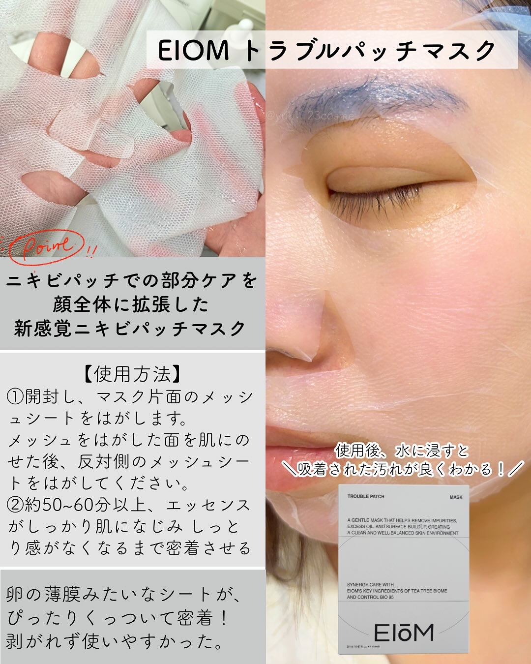 トラブルパッチマスク/EIOM/その他スキンケアを使ったクチコミ（2枚目）