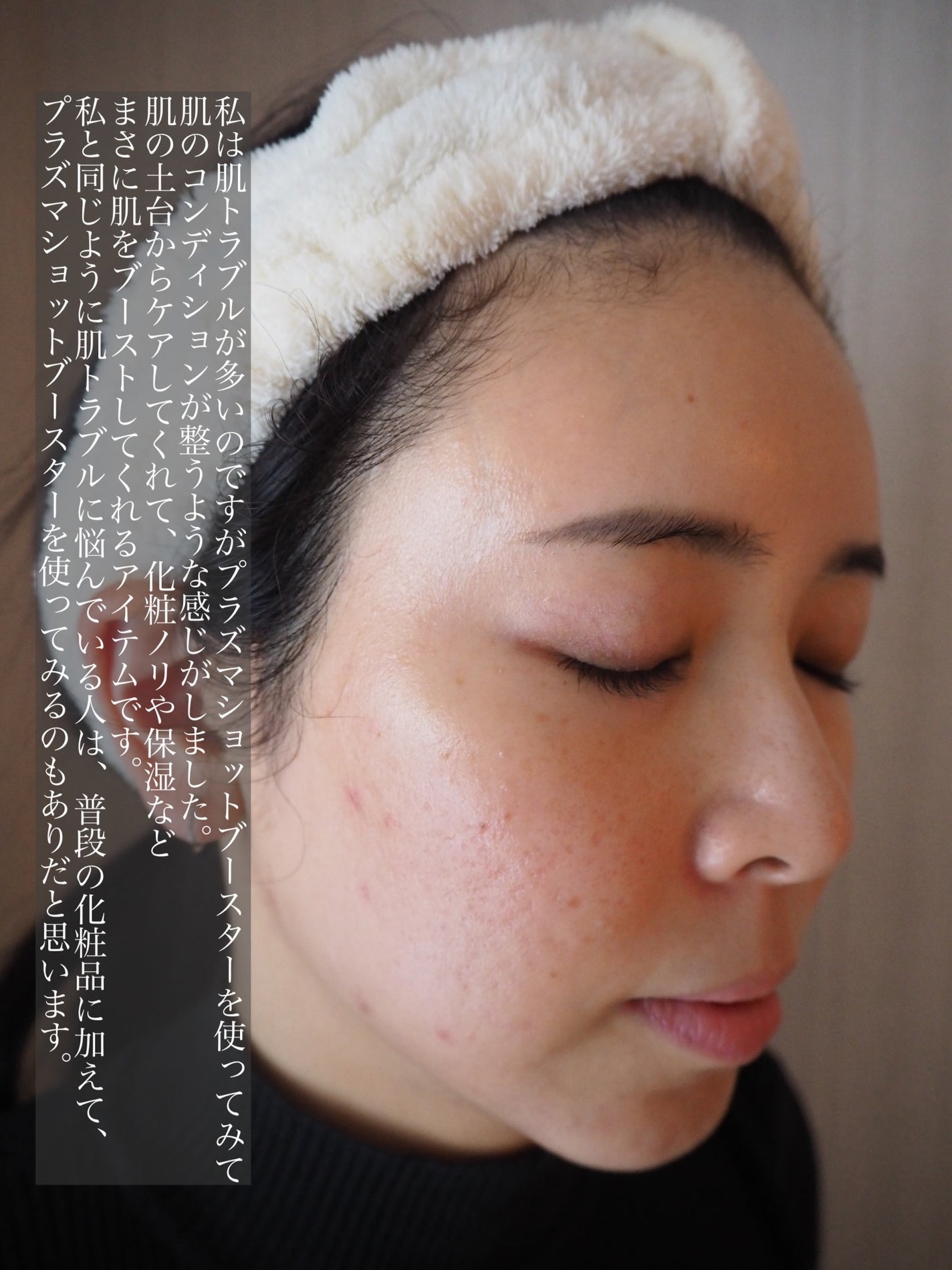 プラズマショットブースター/manyo/美顔器・マッサージを使ったクチコミ(3枚目)