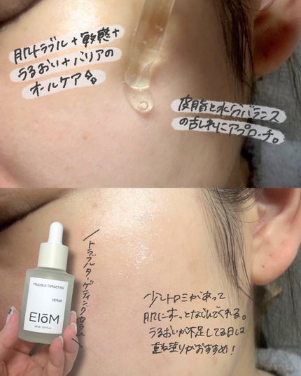 トラブルパッチマスク/EIOM/その他スキンケアを使ったクチコミ(5枚目)