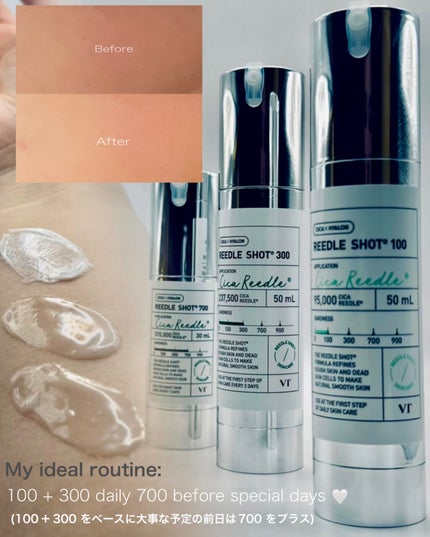 リードルショット100/VT/美容液を使ったクチコミ(4枚目)