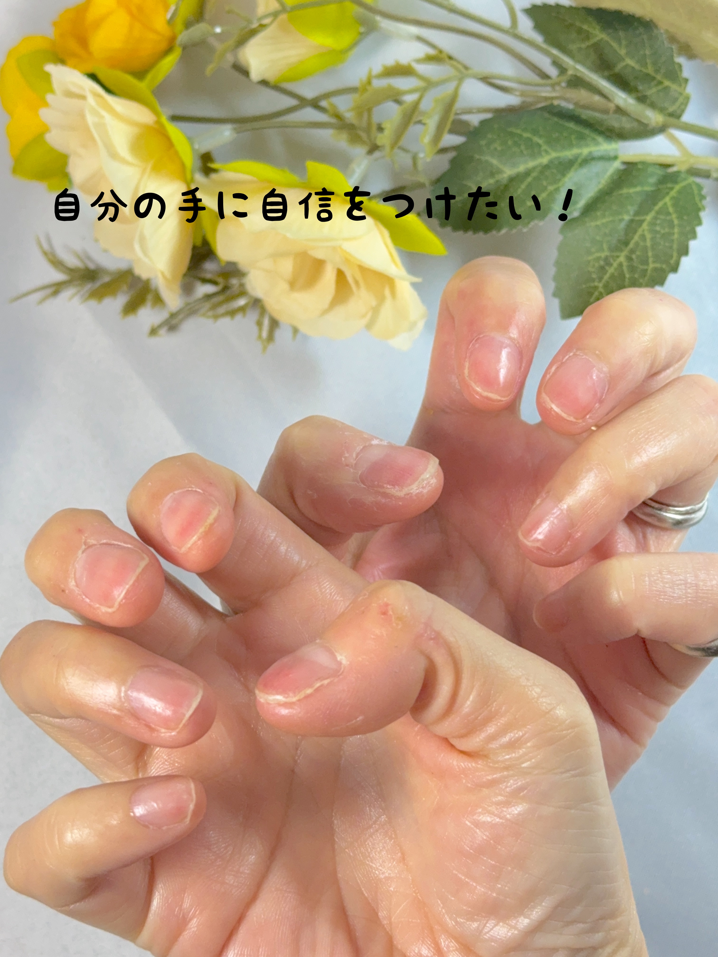 コエンリッチ　ナイトリニュー　ハンドクリーム/コエンリッチQ10/ハンドクリームを使ったクチコミ（3枚目）