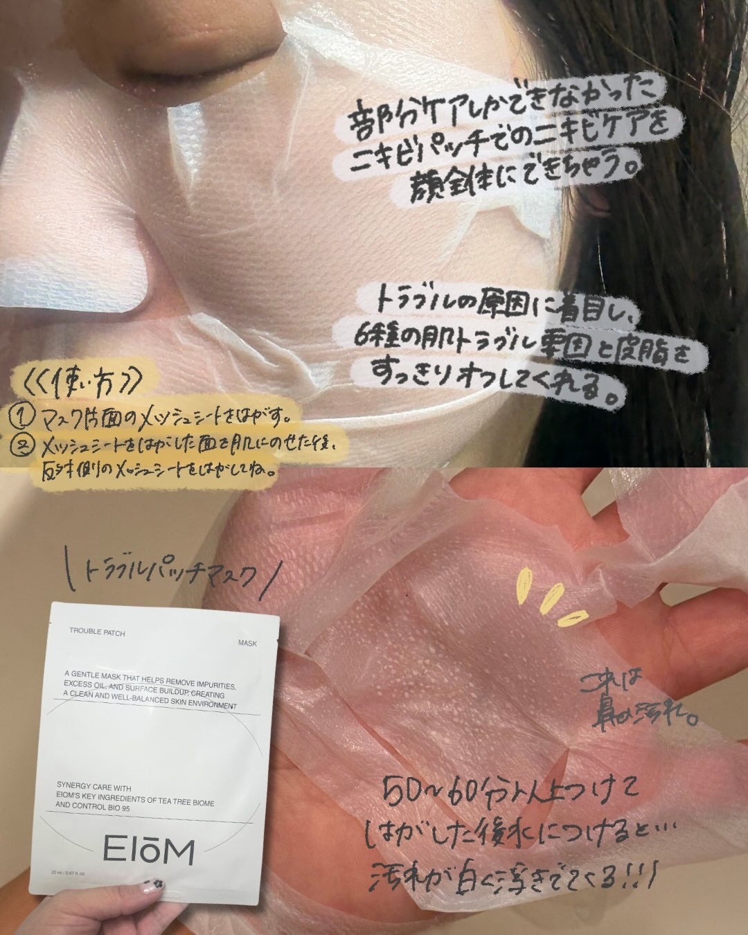 トラブルパッチマスク/EIOM/その他スキンケアを使ったクチコミ(3枚目)