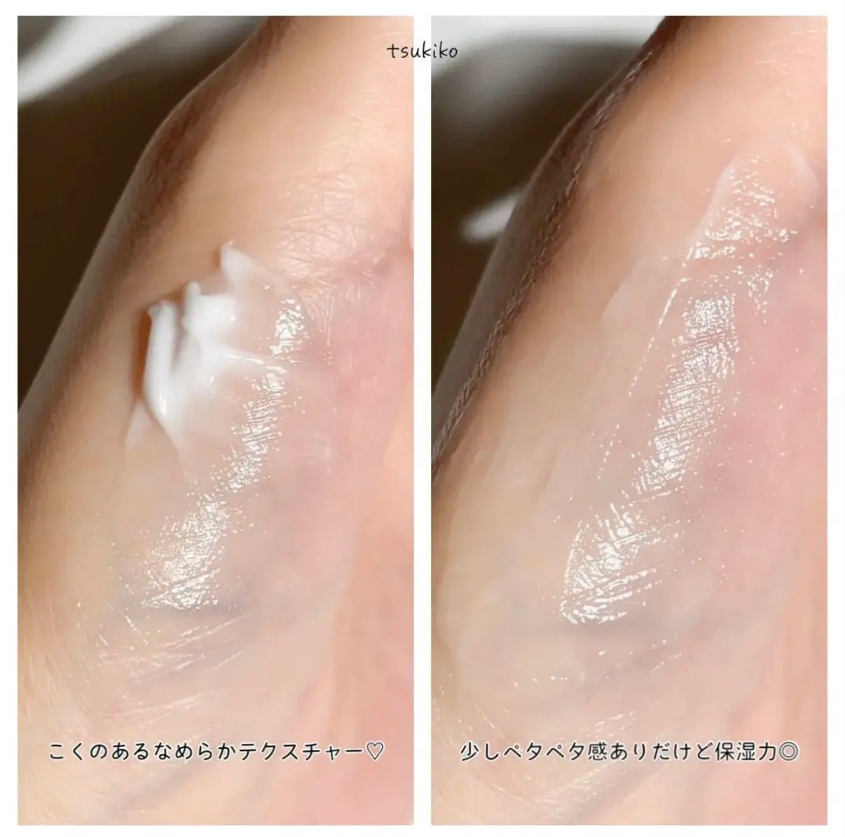 モイスチュア クリーム/カルテHD/フェイスクリームを使ったクチコミ(4枚目)