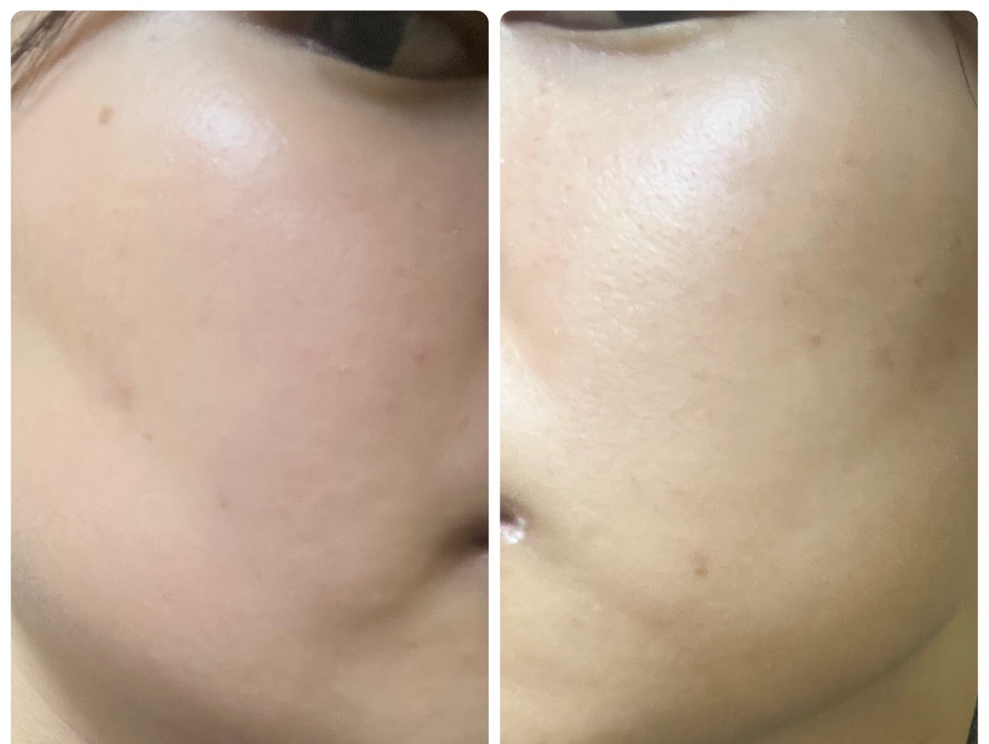 ぽむ on LIPS 「1枚目 2025.12.12エピデュオ 821日目2枚目 20..」(2枚目)