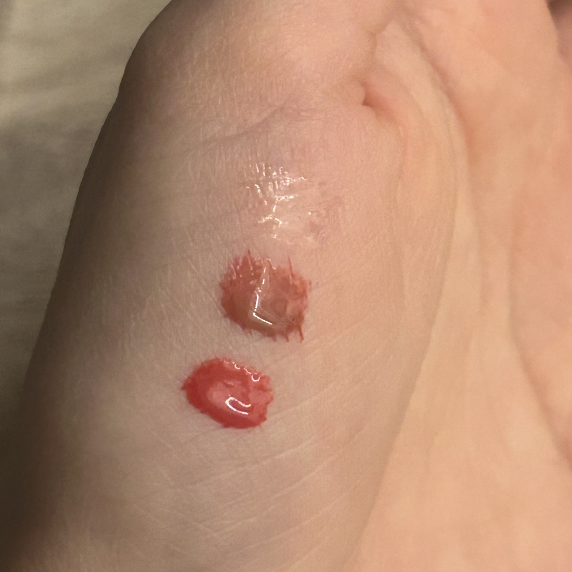 ドトムリッププラスプランパー/keybo/リッププランパーを使ったクチコミ（2枚目）