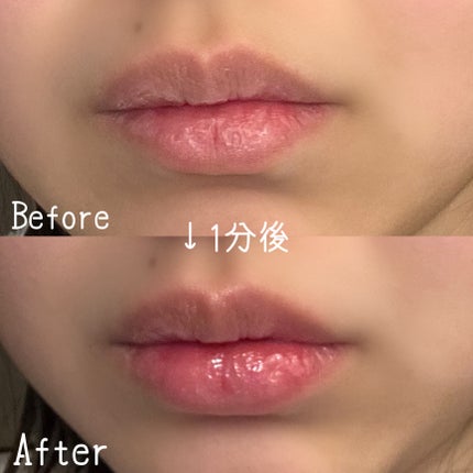 ドトムリッププラスプランパー/keybo/リッププランパーを使ったクチコミ(3枚目)