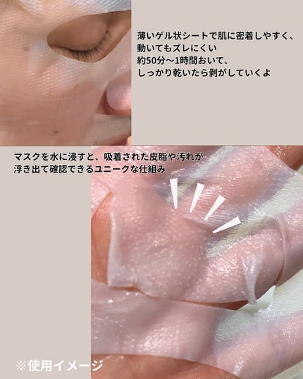 トラブルパッチマスク/EIOM/その他スキンケアを使ったクチコミ(5枚目)