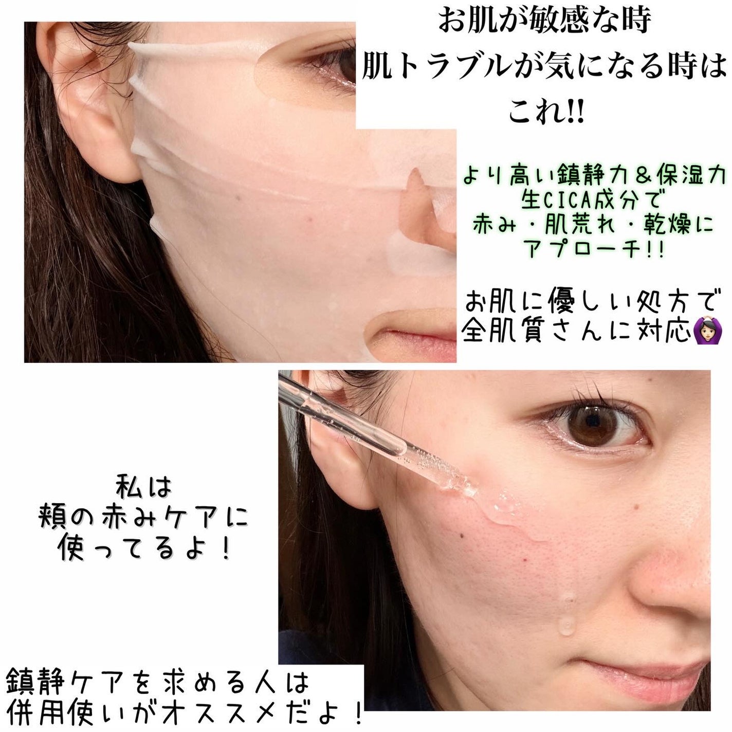 ノスカナイン T セラムマスク S/FATION/シートマスク・パックを使ったクチコミ(4枚目)