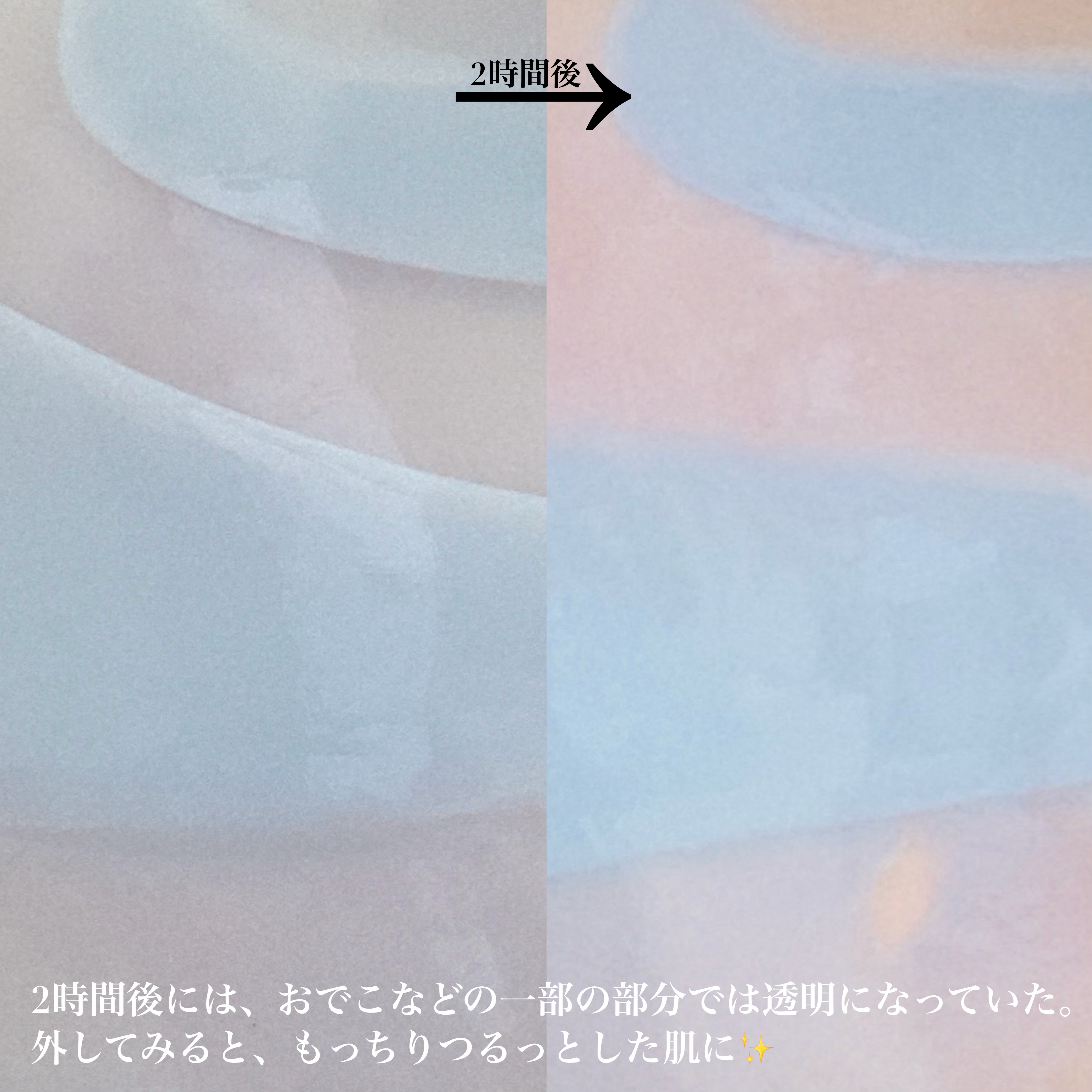 アズレンシカカーミングマスク/from medi+/シートマスク・パックを使ったクチコミ（3枚目）