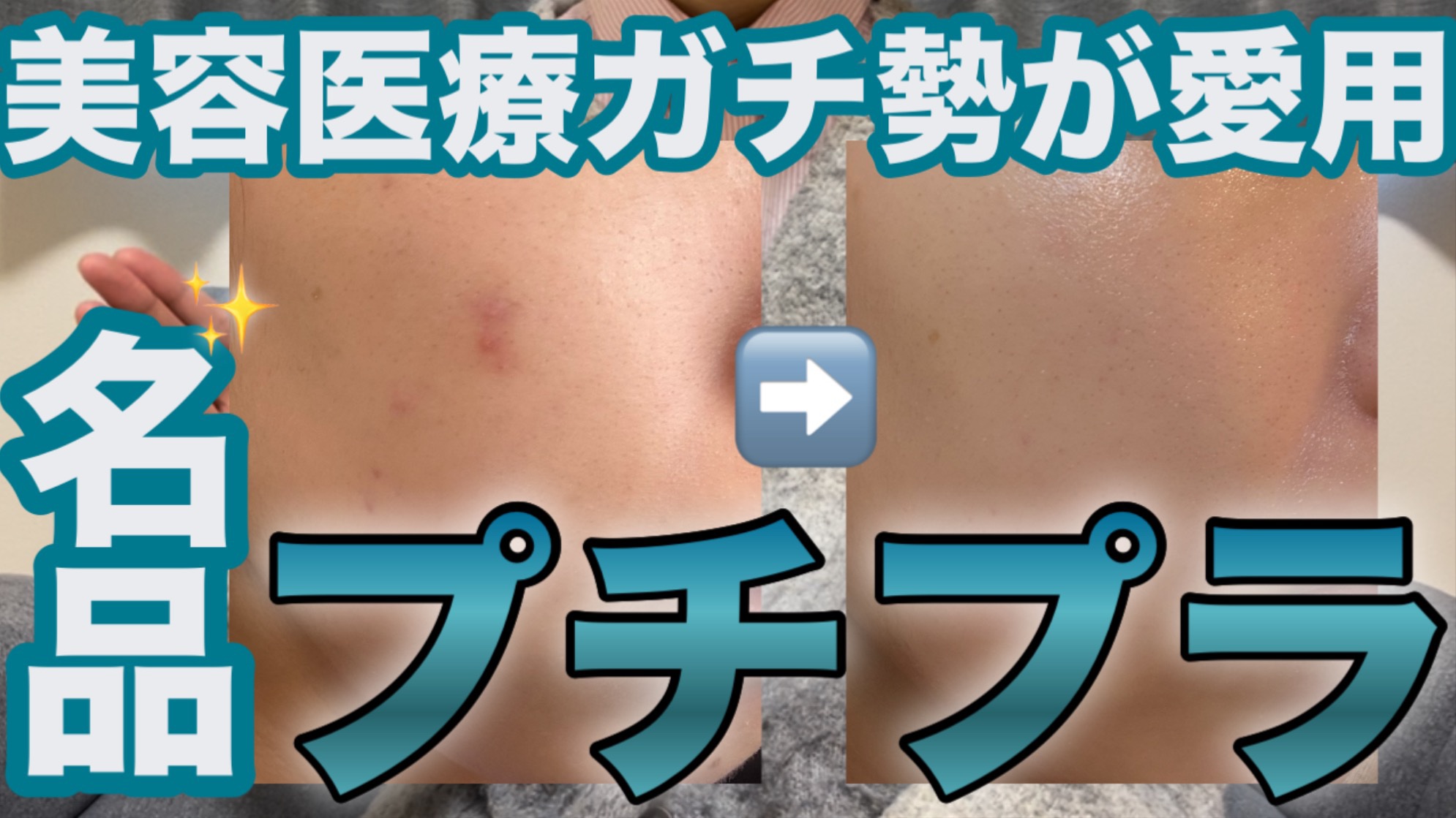 YouTube投稿してます✩.*˚

#美容医療 #美容皮膚科 #スキンケア #プチプラスキンケア