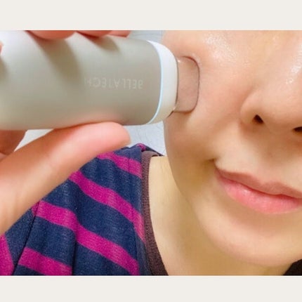 スキンスキャナー/BELLATECH/その他スキンケアグッズを使ったクチコミ(2枚目)