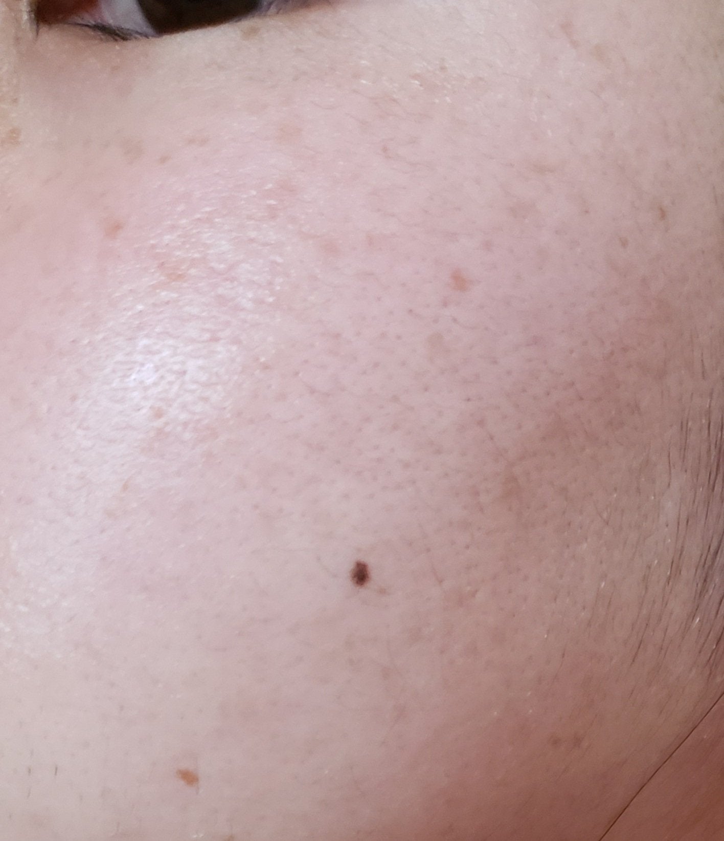 ファーストバランシングトナー/Lowlize/化粧水を使ったクチコミ(4枚目)