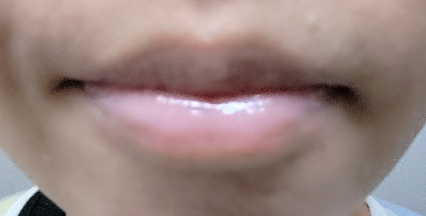 ちゅるリップランパー/muice/リッププランパーを使ったクチコミ(4枚目)