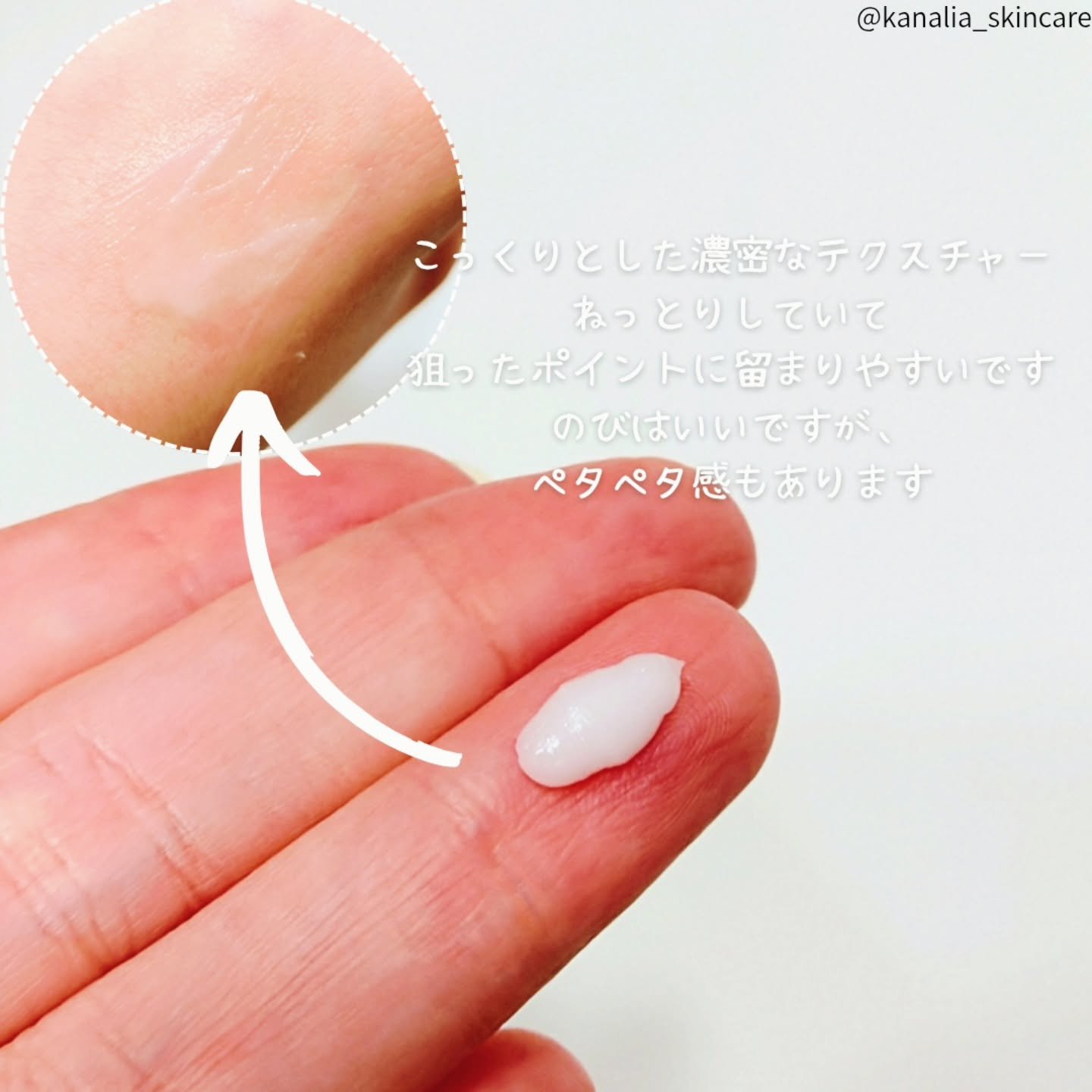 アムリクシア リンクルホワイトスポットセラム/Amrlixir/フェイスクリームを使ったクチコミ（2枚目）