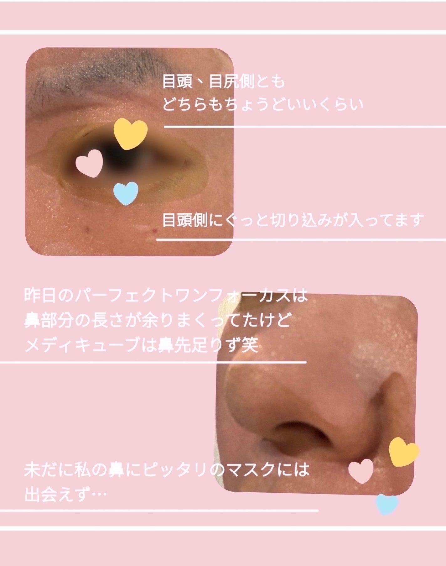 PDRNピンクビタコーティングマスク/MEDICUBE/シートマスク・パックを使ったクチコミ(4枚目)