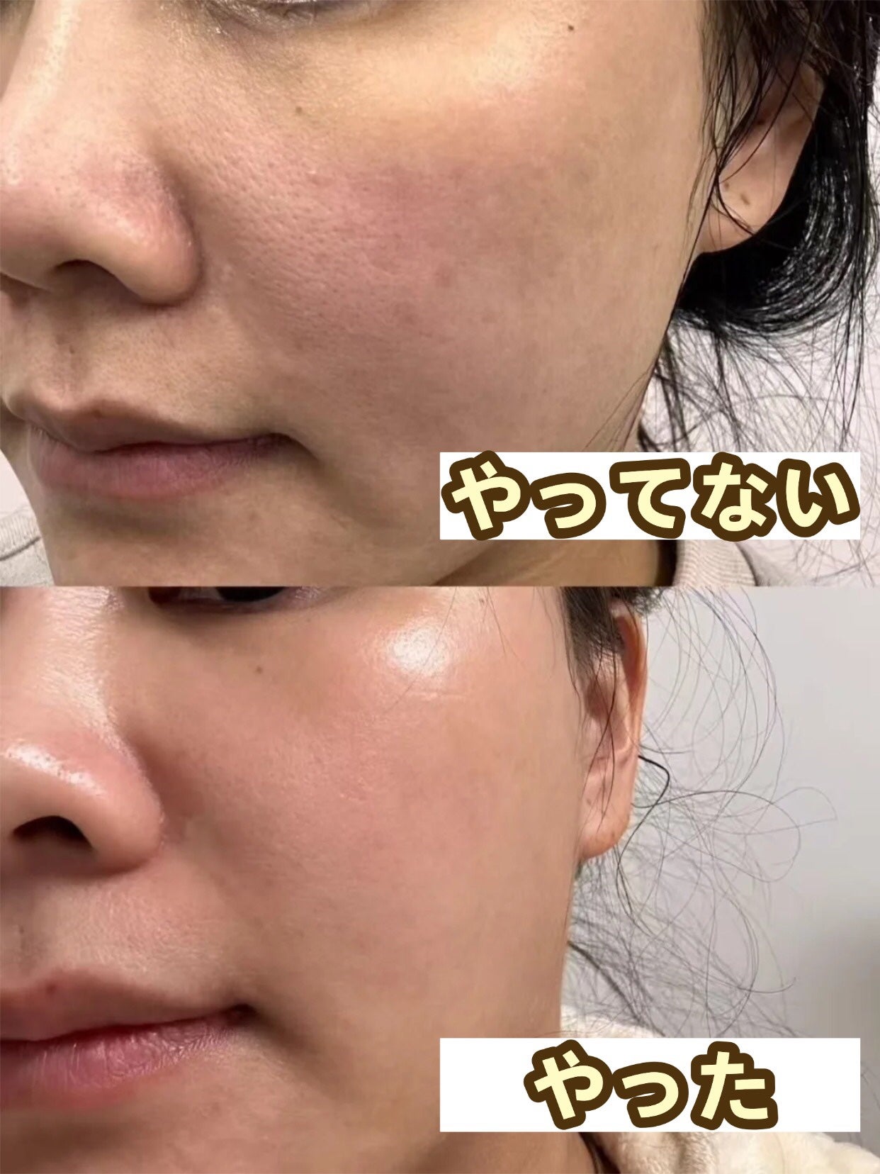 アネトス バランシング トリートメントクリーム/Anetos/フェイスクリームを使ったクチコミ(1枚目)