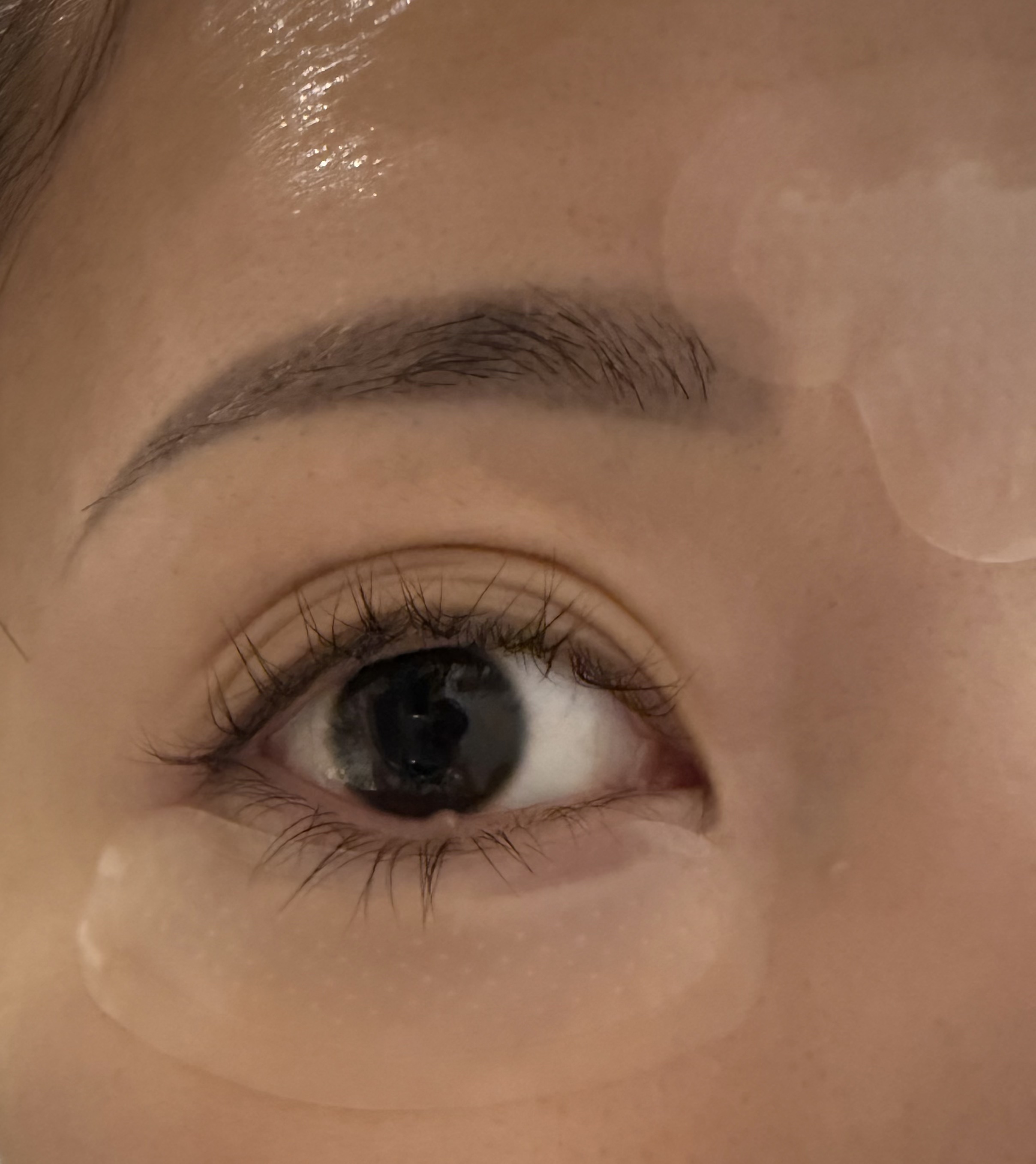 レチアールエヌ スリムパッチ 3パウチ入り（6パッチ/3回分）/ACROPASS/シートマスク・パックを使ったクチコミ（3枚目）