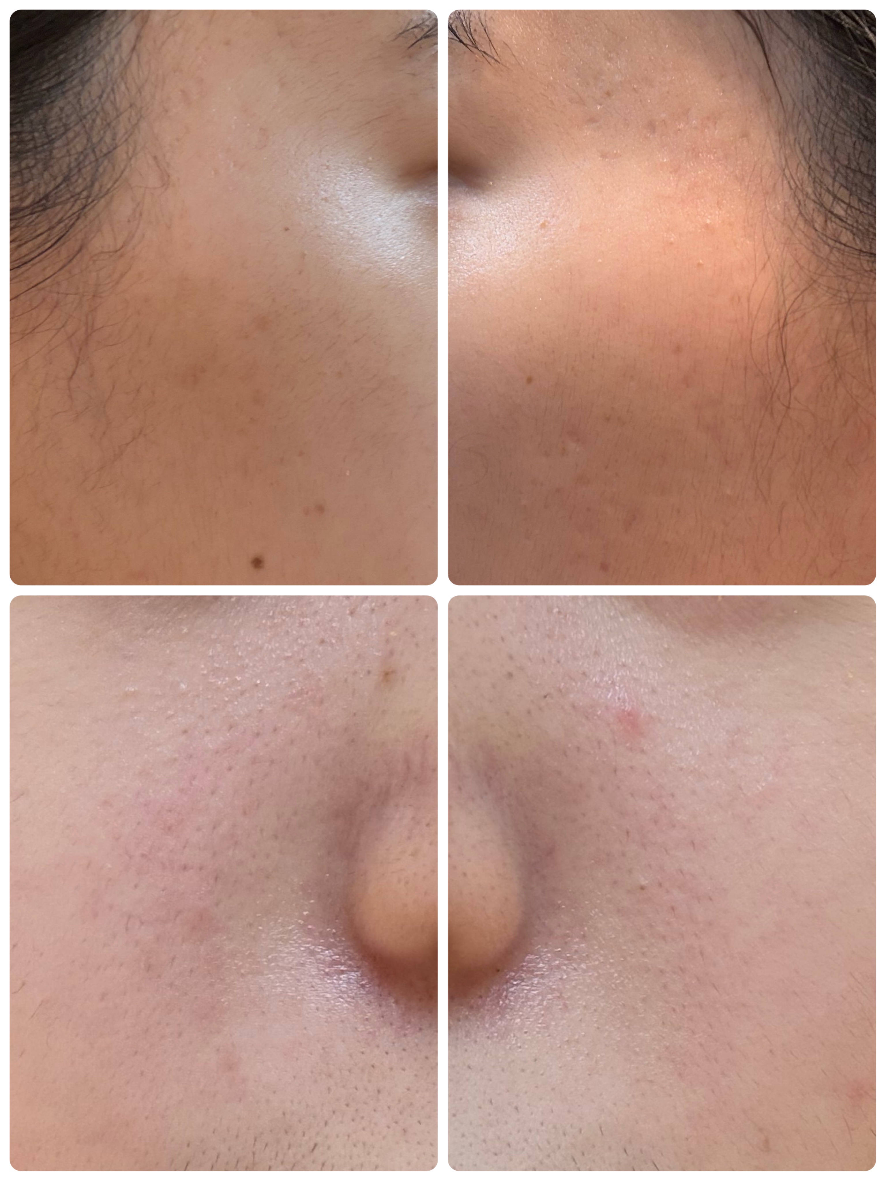 ディズム EMS EER メディスキンケアデバイス/DISM/美顔器・マッサージを使ったクチコミ（2枚目）