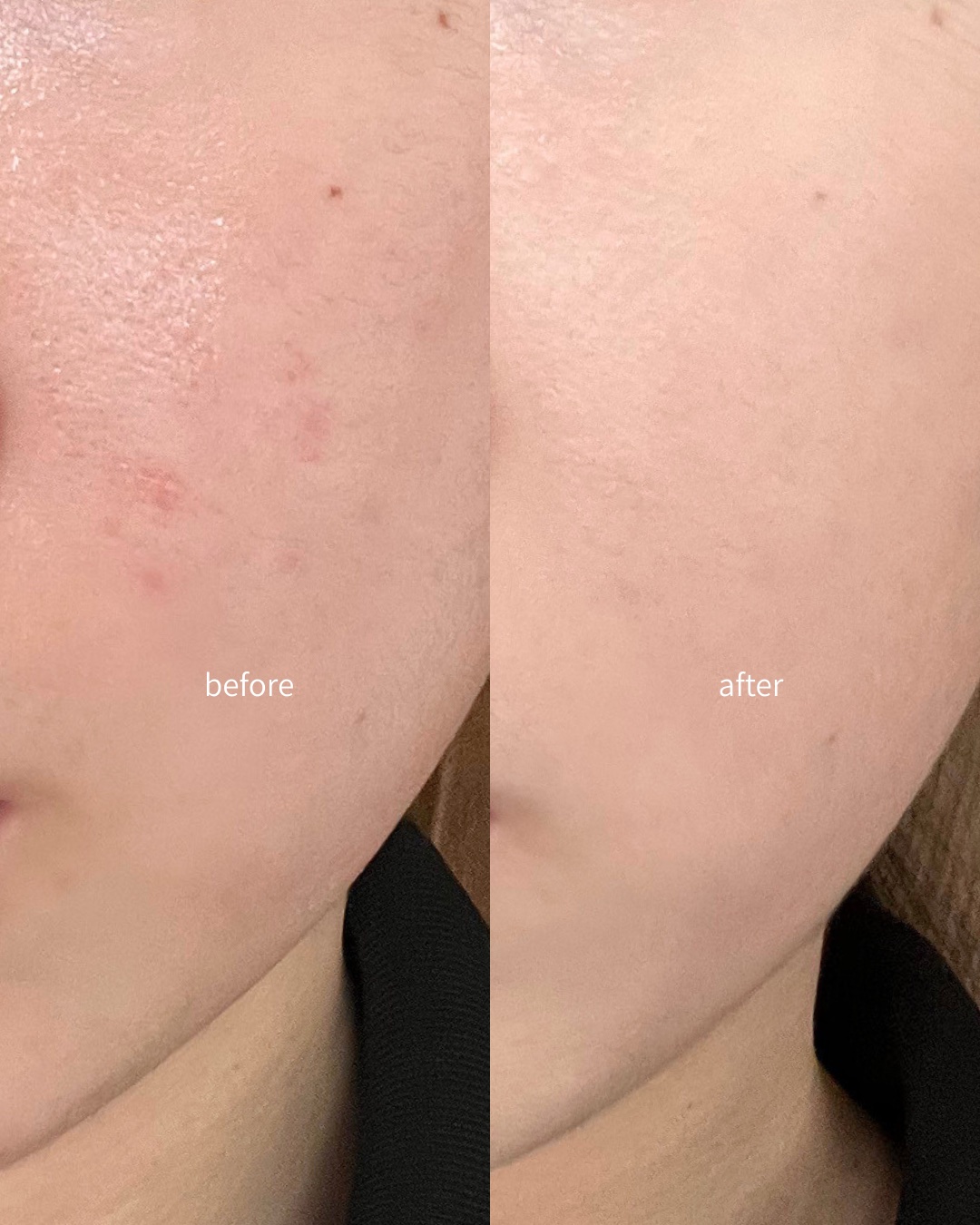 カバーアッププロコンシーラー/TFIT/パレットコンシーラーを使ったクチコミ（3枚目）