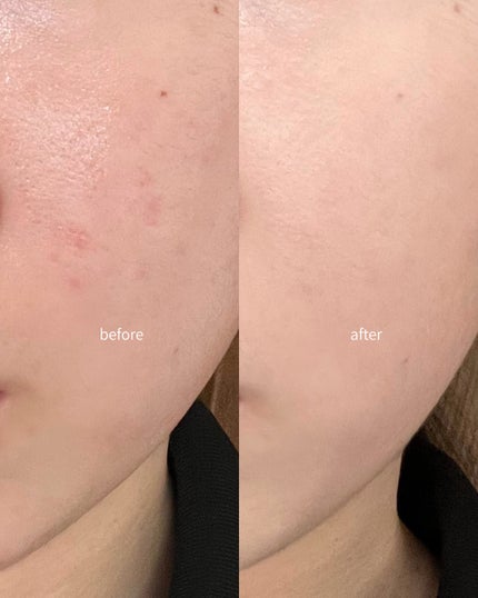 カバーアッププロコンシーラー/TFIT/パレットコンシーラーを使ったクチコミ(3枚目)