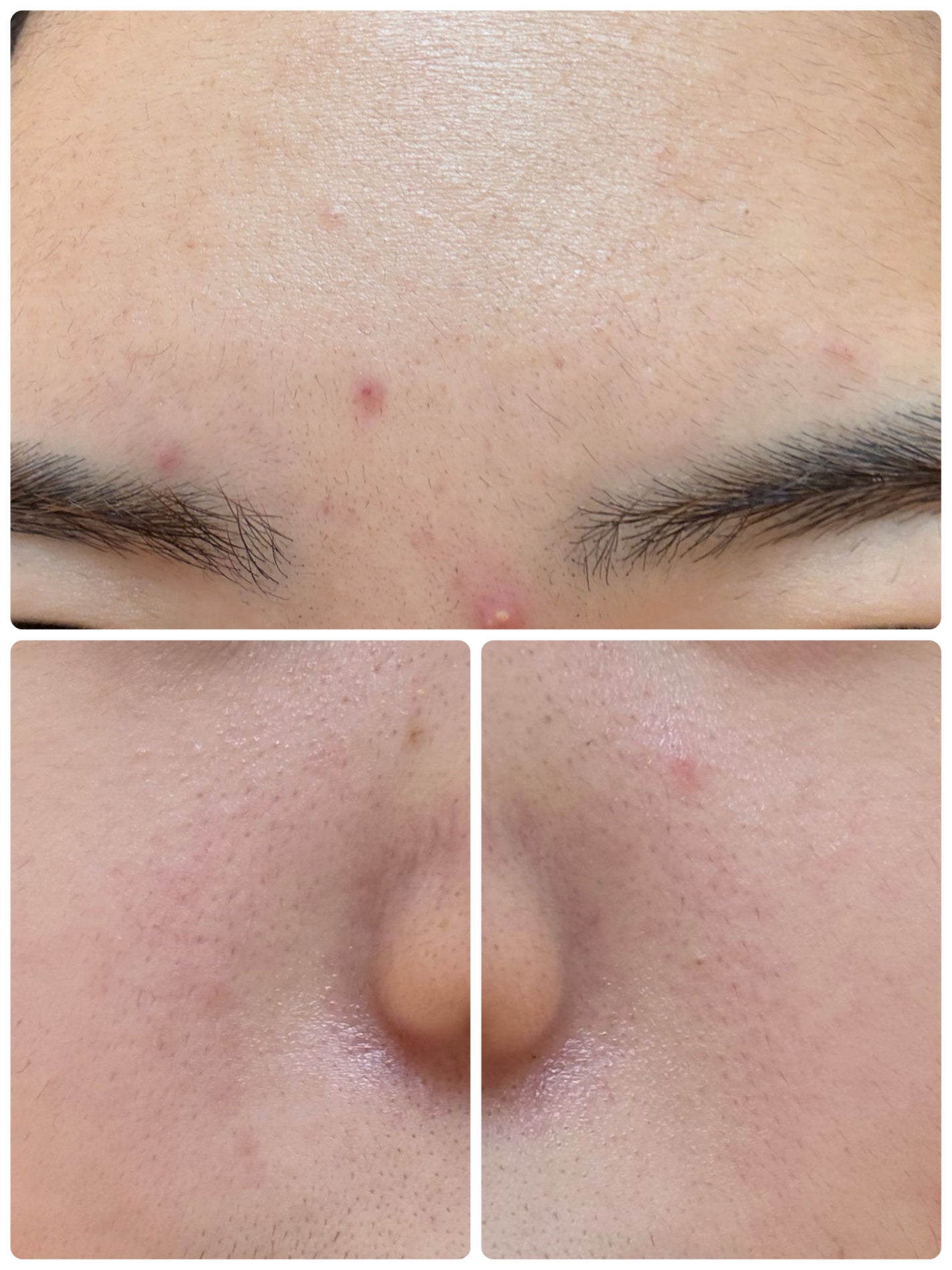 モーニングジェルウォッシュ/ビトレスキン/その他洗顔料を使ったクチコミ(3枚目)